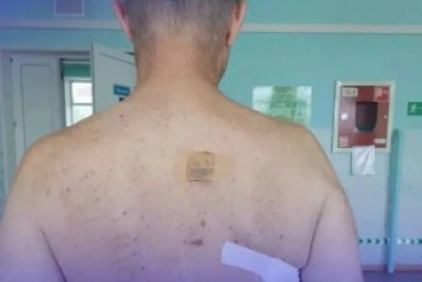 Мужчине вонзили нож в спину во время бытового конфликта в Приморье
